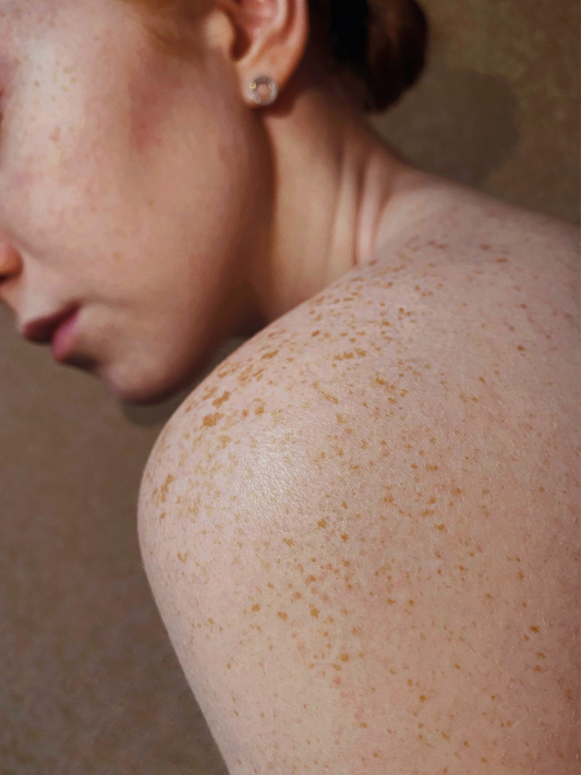 Skin tech